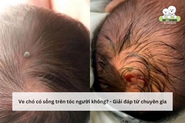 Giải đáp: Ve chó có sống trên tóc người được không? Giải đáp: Ve chó có sống trên tóc người được không?