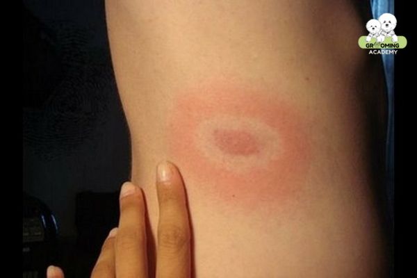 Ve chó có thể ký sinh trên da và hút máu người Ve chó có thể ký sinh trên da và hút máu người